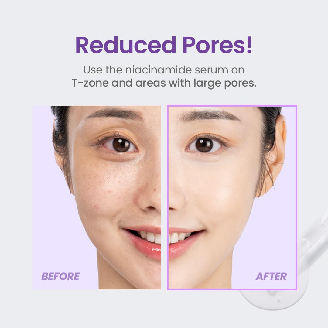 TIRTIR Niacinamide 20% Serum in a routine setup with other skincare products.