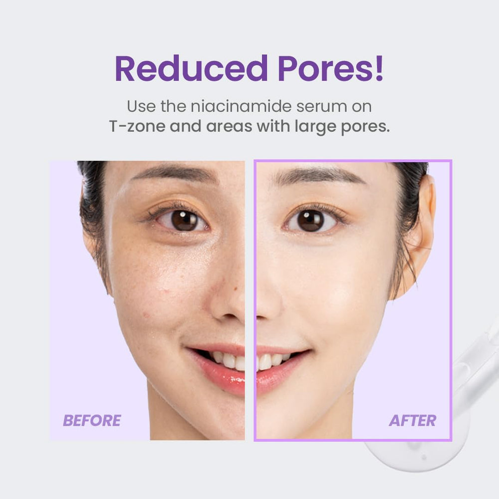 TIRTIR Niacinamide 20% Serum in a routine setup with other skincare products.