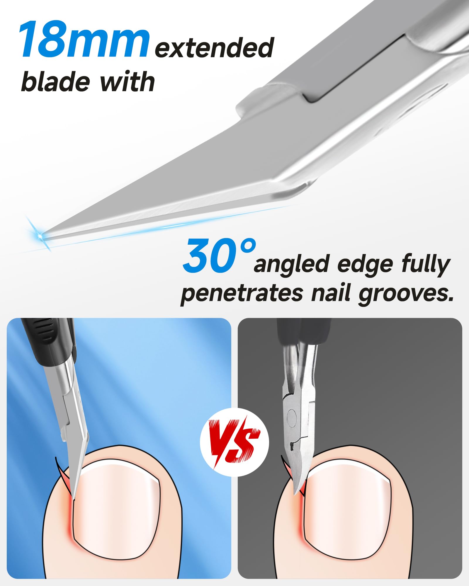Tisojpod ingrown-nail-tip angled view demonstrates deep groove access for precise trimming
