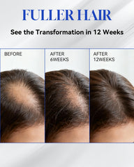 TJE Hair Growth Serum Roll On label closeup highlights clean formula for all hair types.