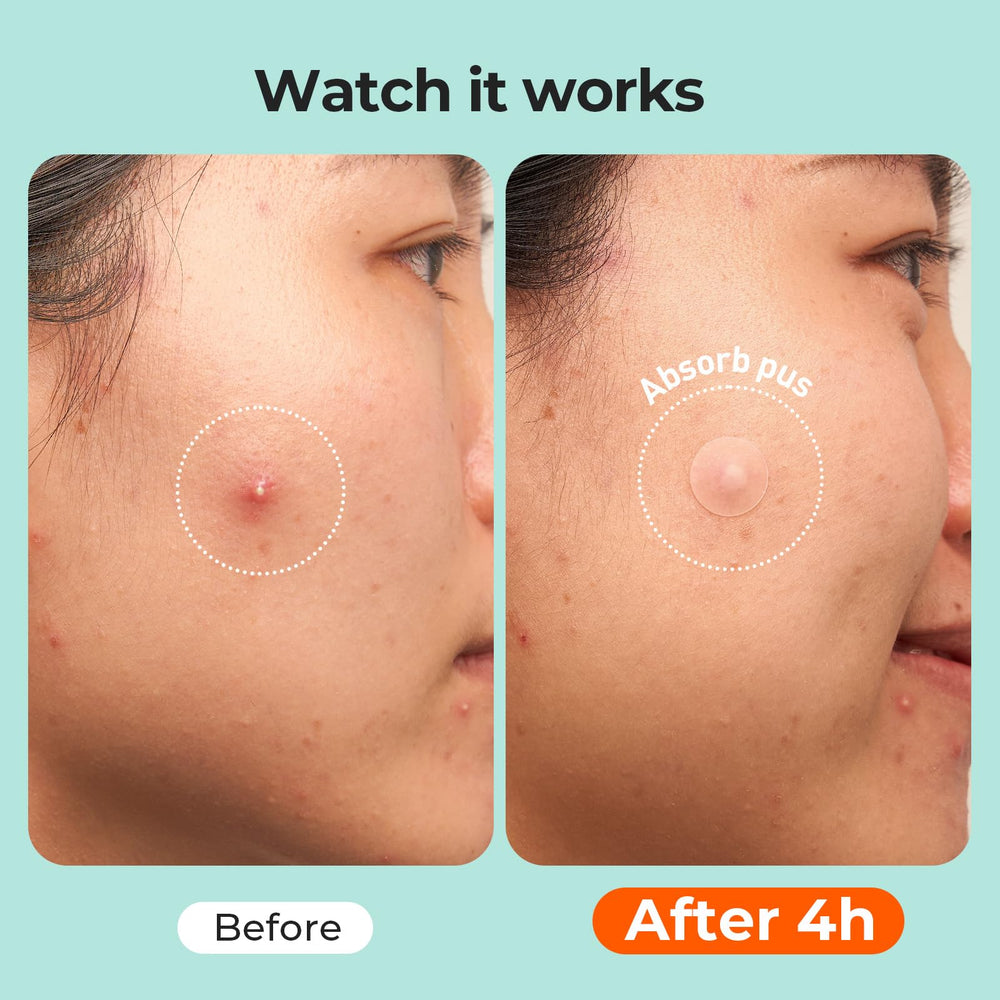 TKTK individual wrapping detail emphasizing hygiene and travel-ready benefit