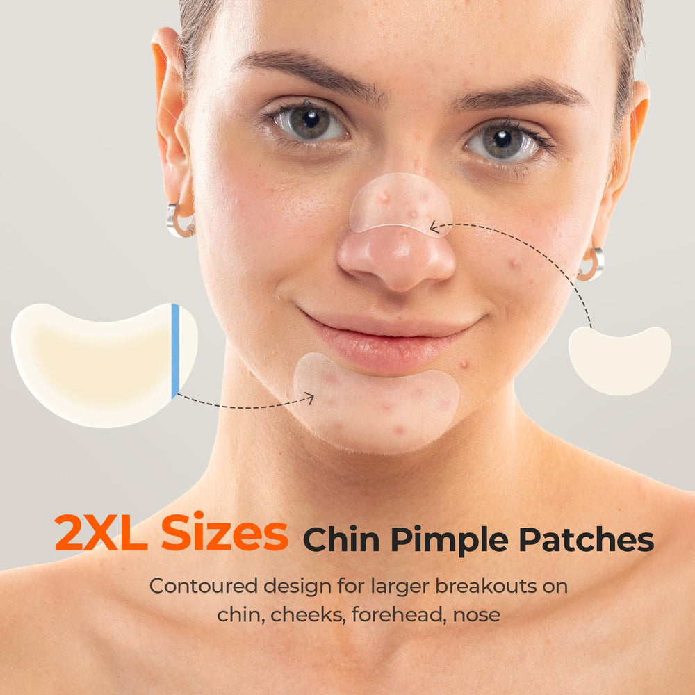 TKTK large crescent patch fits chin clusters for overnight wear.