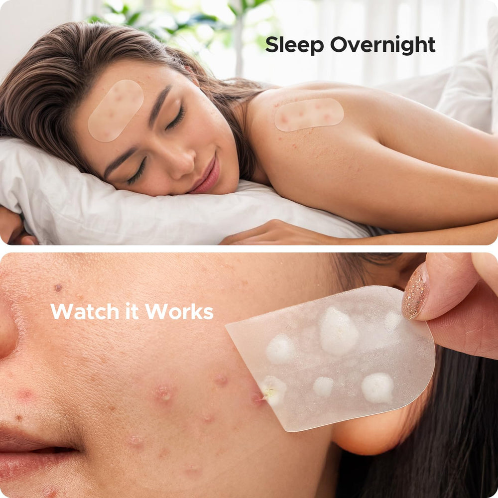 TKTK 12mm dot fits medium lesions on forehead or chin.