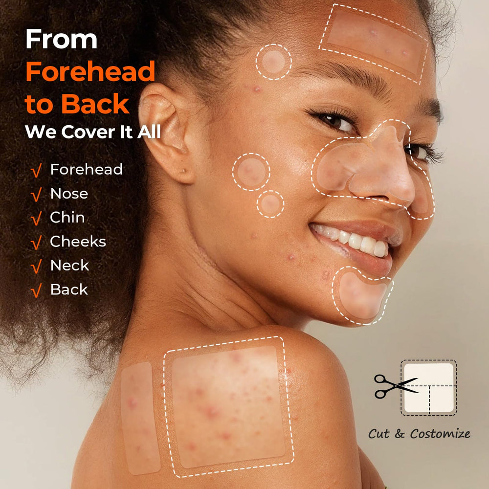 TKTK Pimple Patches back-cheek patch 60x60mm for back and cheek blemishes