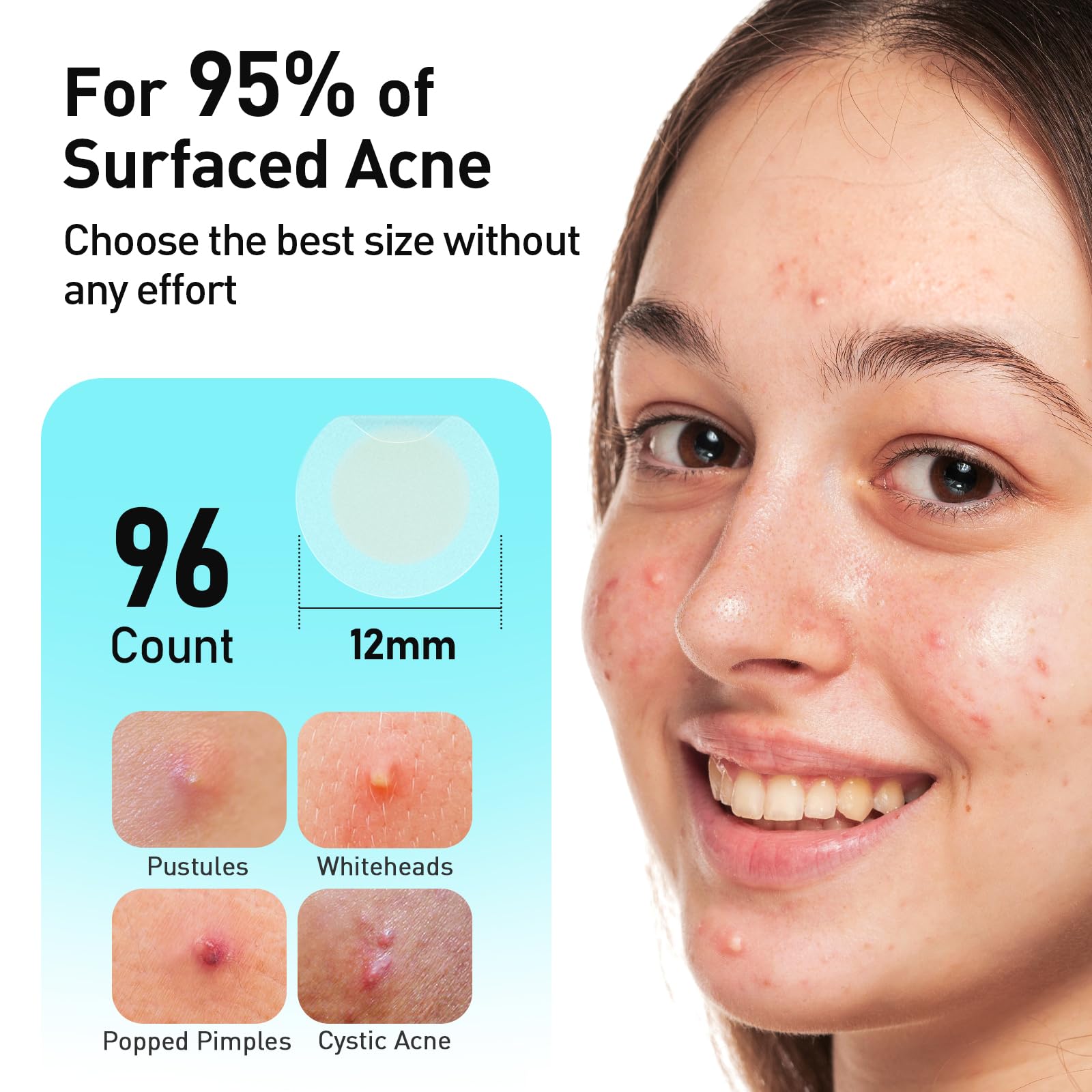 TKTK Pimple Patches easy peel strip for sanitary, mess-free application