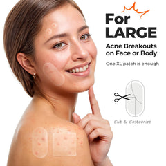 TKTK oval 60x30mm patch on skin highlights broad-area coverage.
