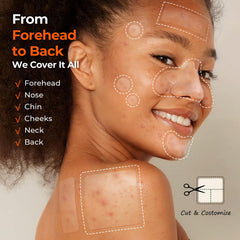 TKTK Pimple Patches small sizes image highlights patches for small to medium zits.