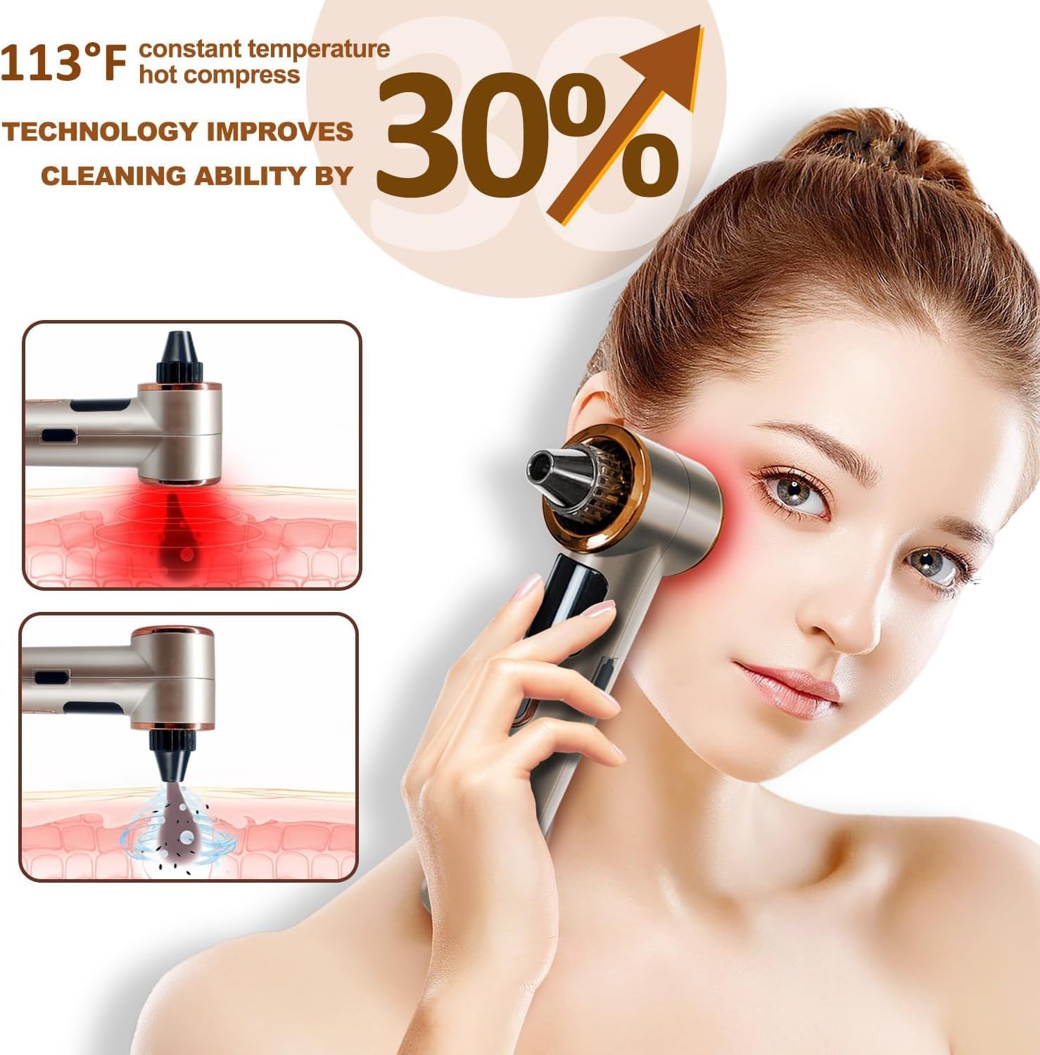 Tlettsteinkle five suction heads enabling targeted pore care