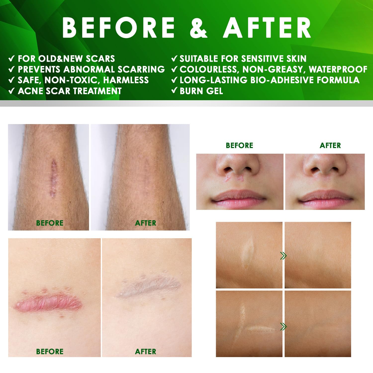 Tobcharm silicone gel hydration support image highlights skin hydration and elasticity.