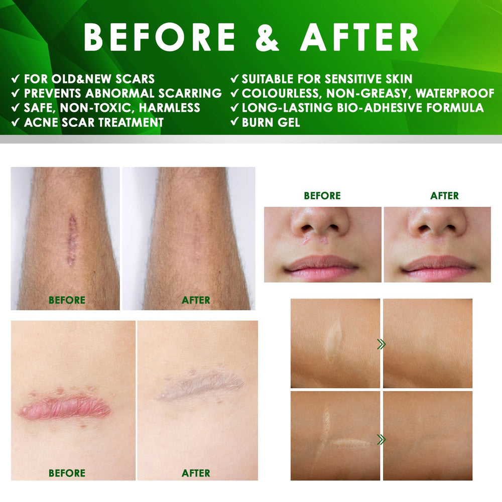 Tobcharm silicone gel hydration support image highlights skin hydration and elasticity.