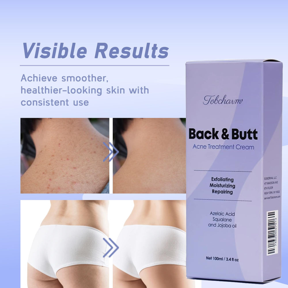 Tobcharm skin-clearance texture close-up highlighting gentle exfoliation for blemish-prone areas.