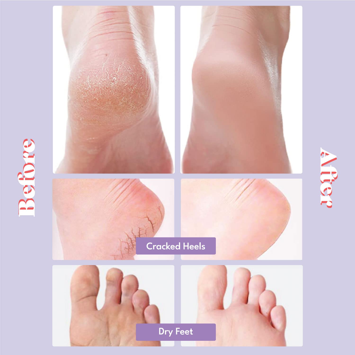 TOI:L Extra Silky Foot Mask socks open reveal nourishing oils for dry feet