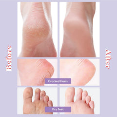 TOI:L Extra Silky Foot Mask socks open reveal nourishing oils for dry feet