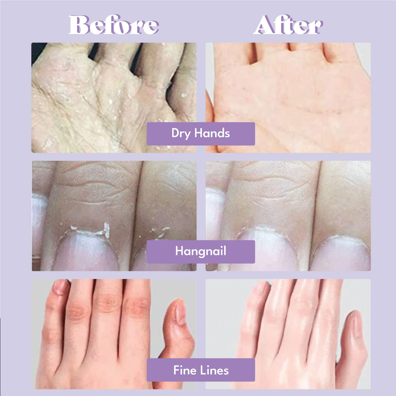 TOI:L hand mask application on hands emphasizes easy 20-minute ritual for lasting moisture.