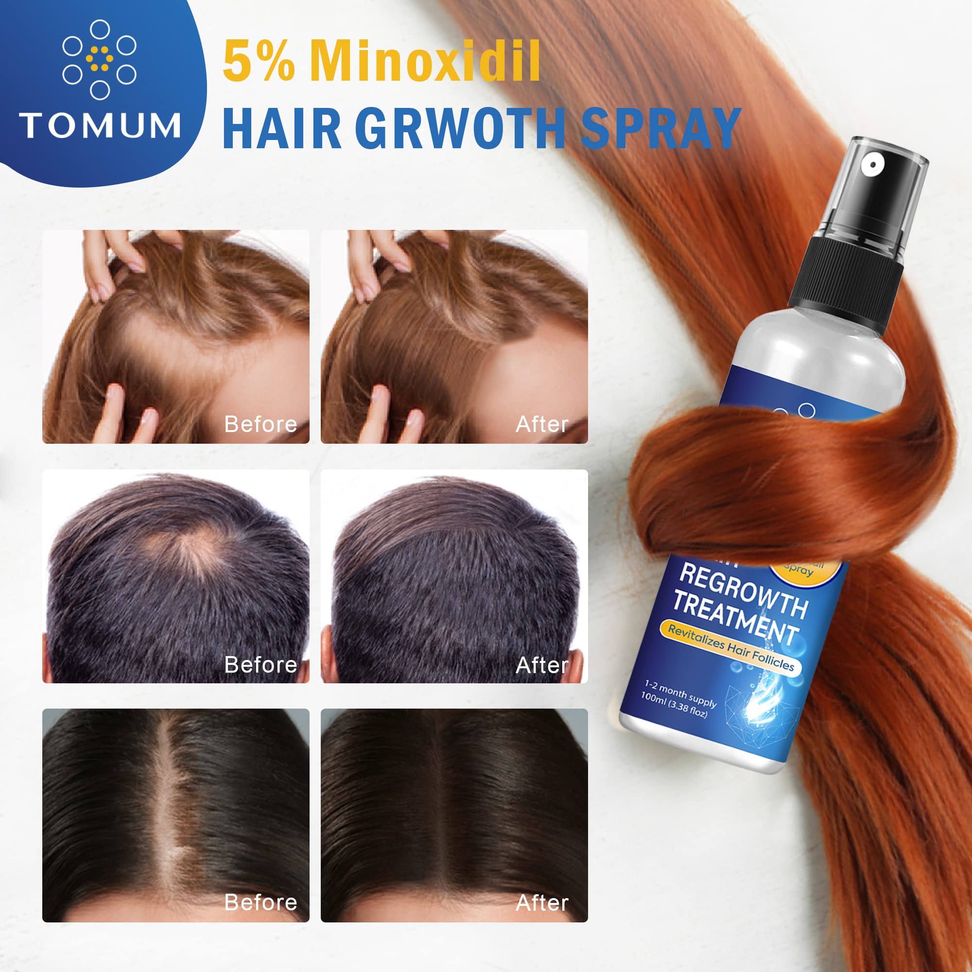 Tomum Minoxidil packaging box highlighting 100ml bottle.