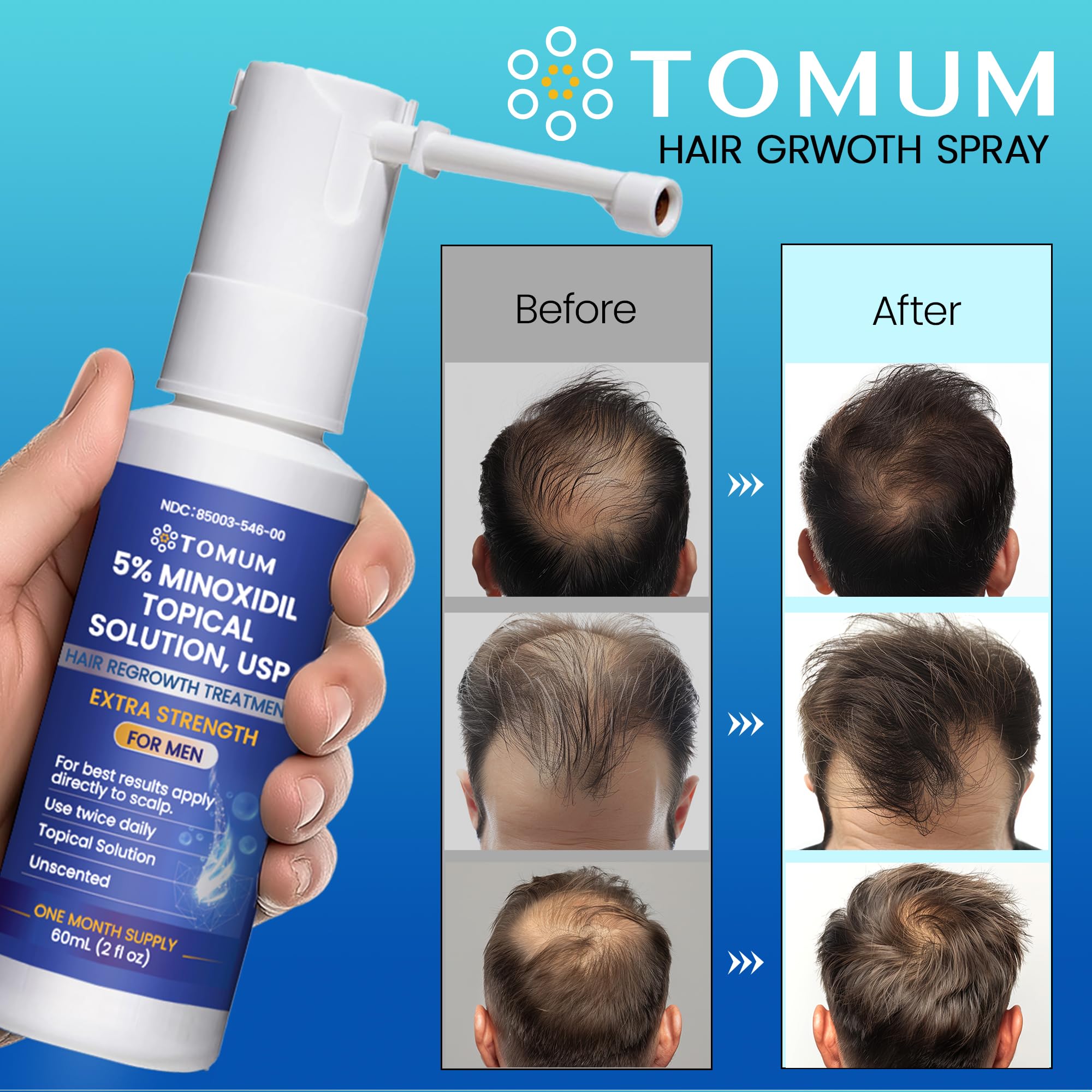 TOMUM minoxidil spray in daily routine shows simple, consistent use.