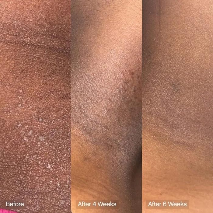 Topicals Faded cleansing bar lactic acid micro-detail shows gentle exfoliation