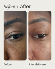 Topicals Sealed on-face view shows retinol and salicylic acid action