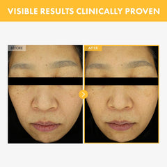 TOSOWOONG 8 Days Spot Cream ingredients close-up highlighting brightening actives