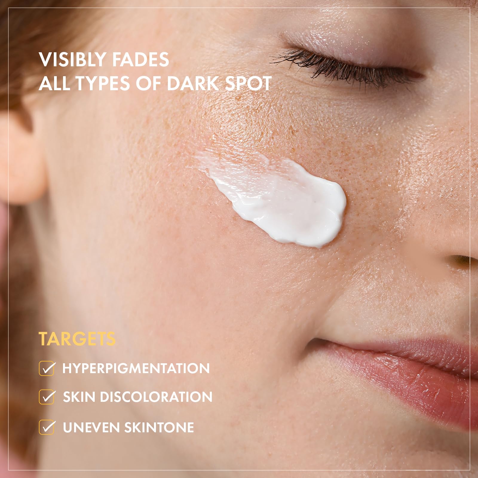 TOSOWOONG Dark spots face swatch visualizing fading discoloration