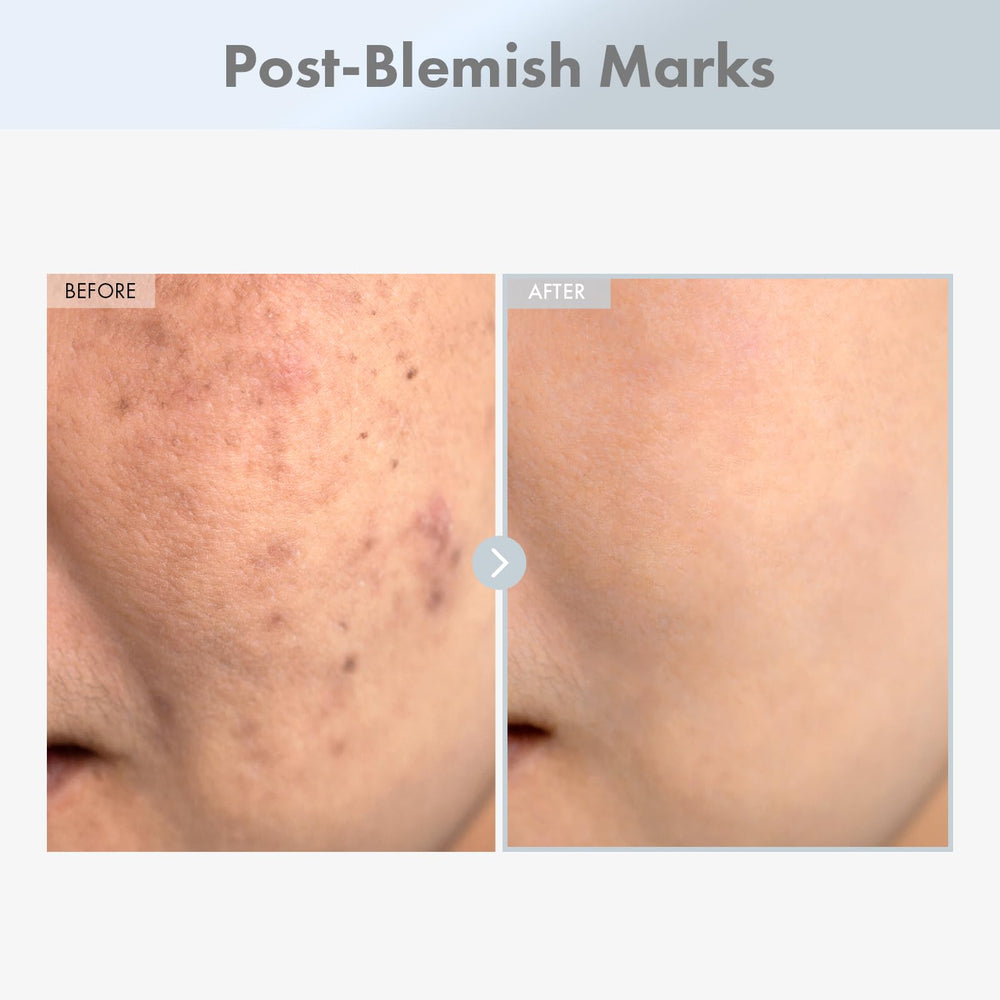 TOSOWOONG Niacinamide 15% serum swirl on skin shows smooth texture