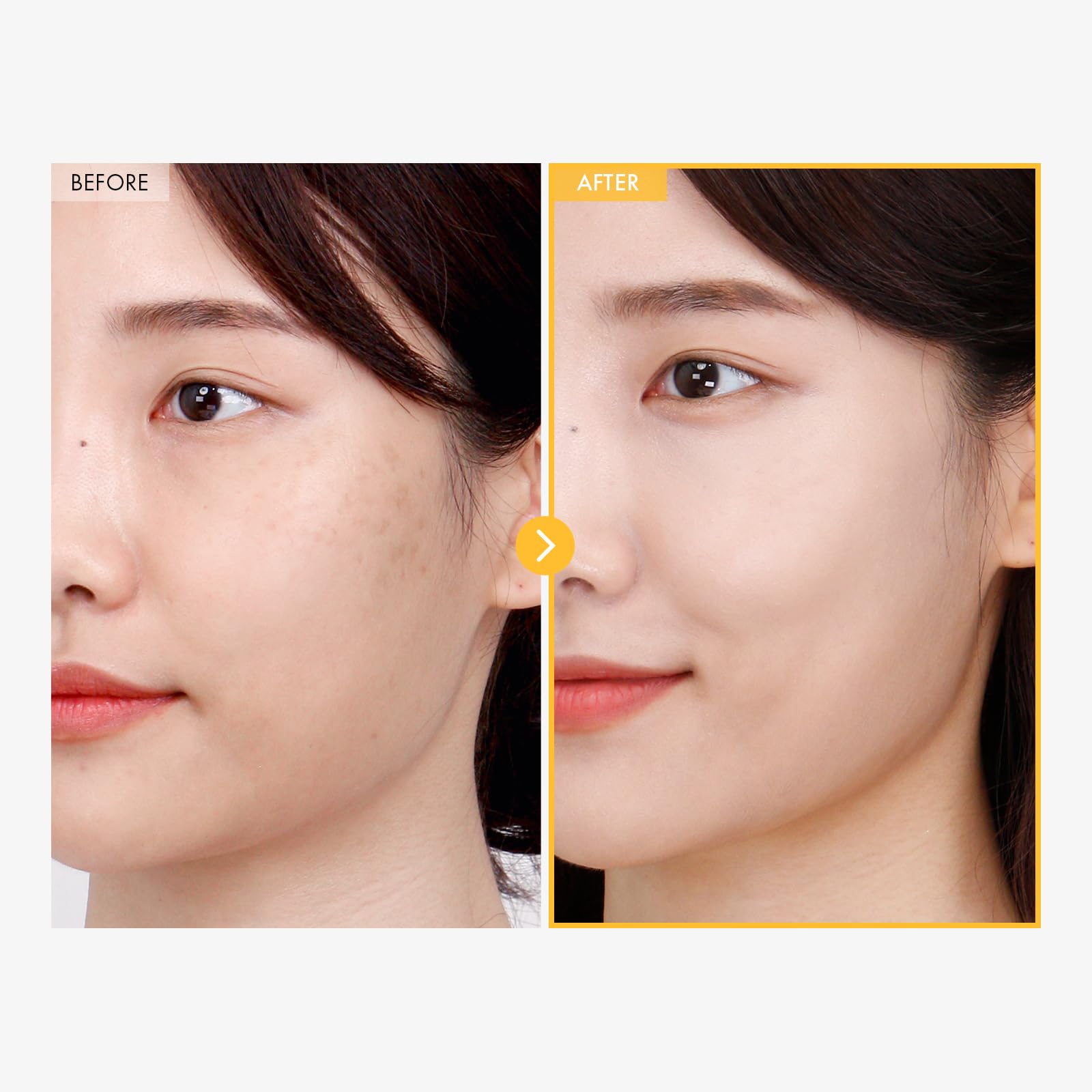 TOSOWOONG 8 Days Spot Cream application routine showing easy daily use