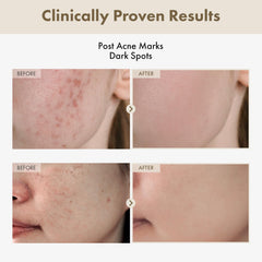 TOSOWOONG Alpha Arbutin 2 Rice Serum dropper action shows precise application for radiant skin.