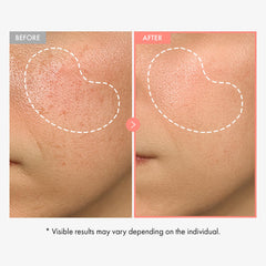 TOSOWOONG alpha-arbutin serum swatch highlights brightening potential for even tone