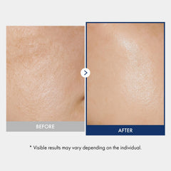 TOSOWOONG application on hand demonstrating quick absorption and soothing