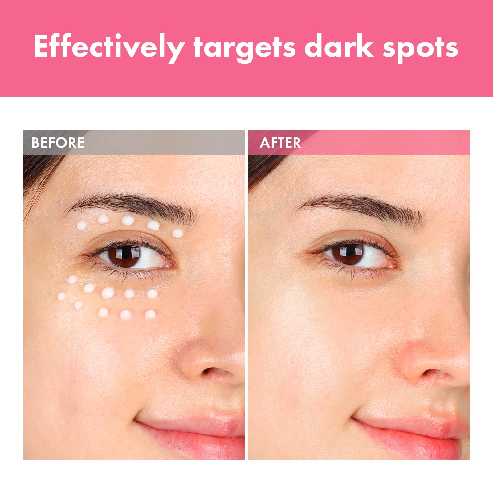 TOSOWOONG Arbutin 7% Spot Cream packaging highlighting fragrance-free formula.
