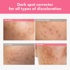 TOSOWOONG Arbutin 7% Spot Cream texture swirl illustrating creamy hydration.