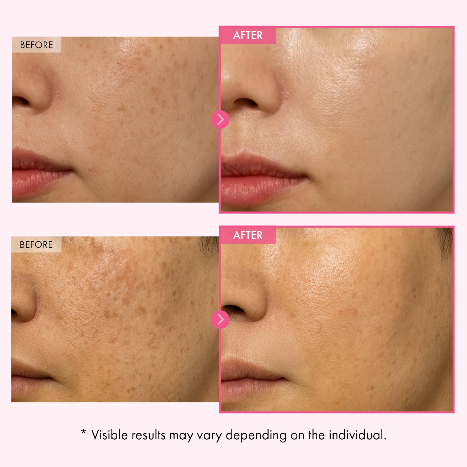 TOSOWOONG Arbutin Cream texture swatch demonstrating lightweight, non-greasy absorption on skin.