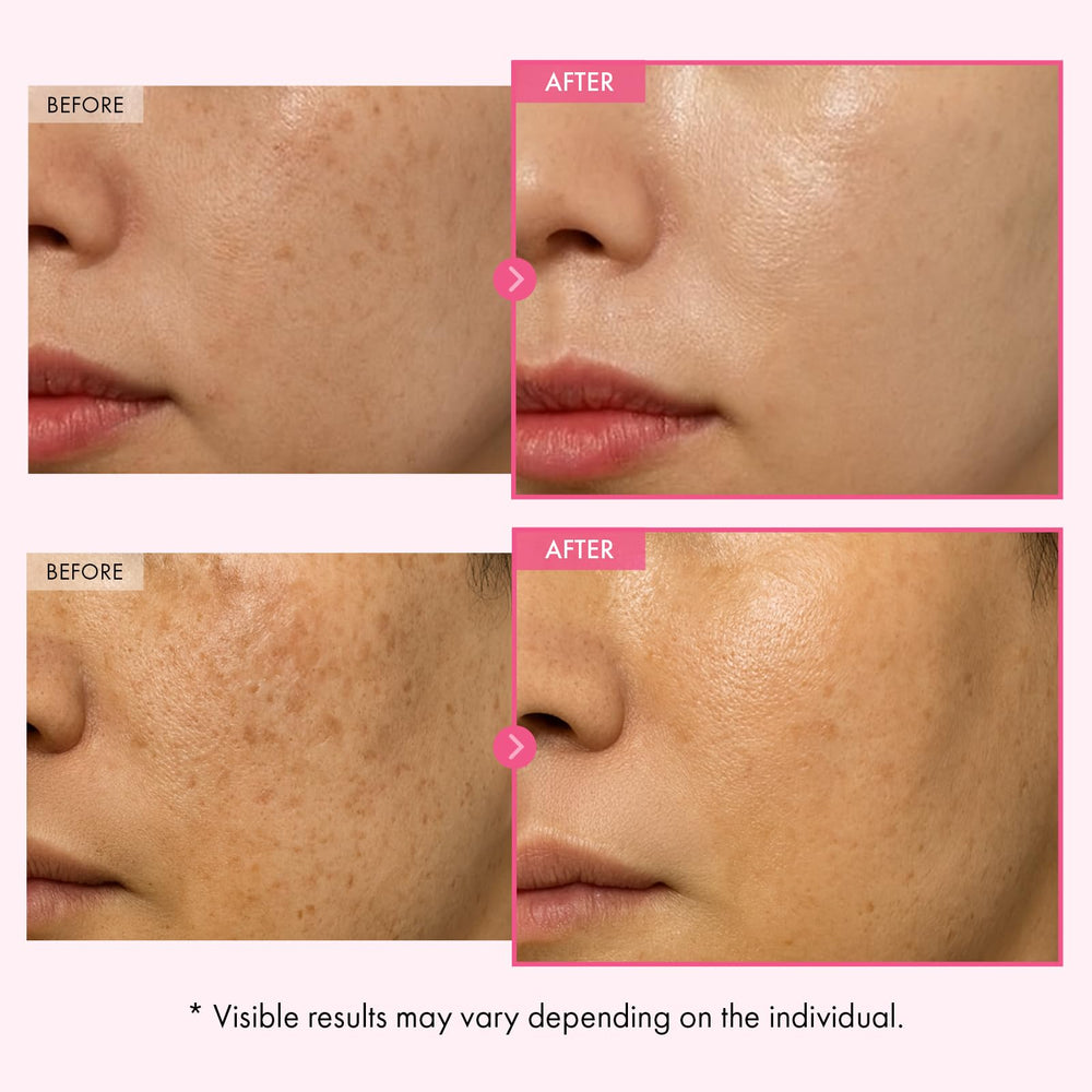 TOSOWOONG Arbutin Cream texture swatch demonstrating lightweight, non-greasy absorption on skin.