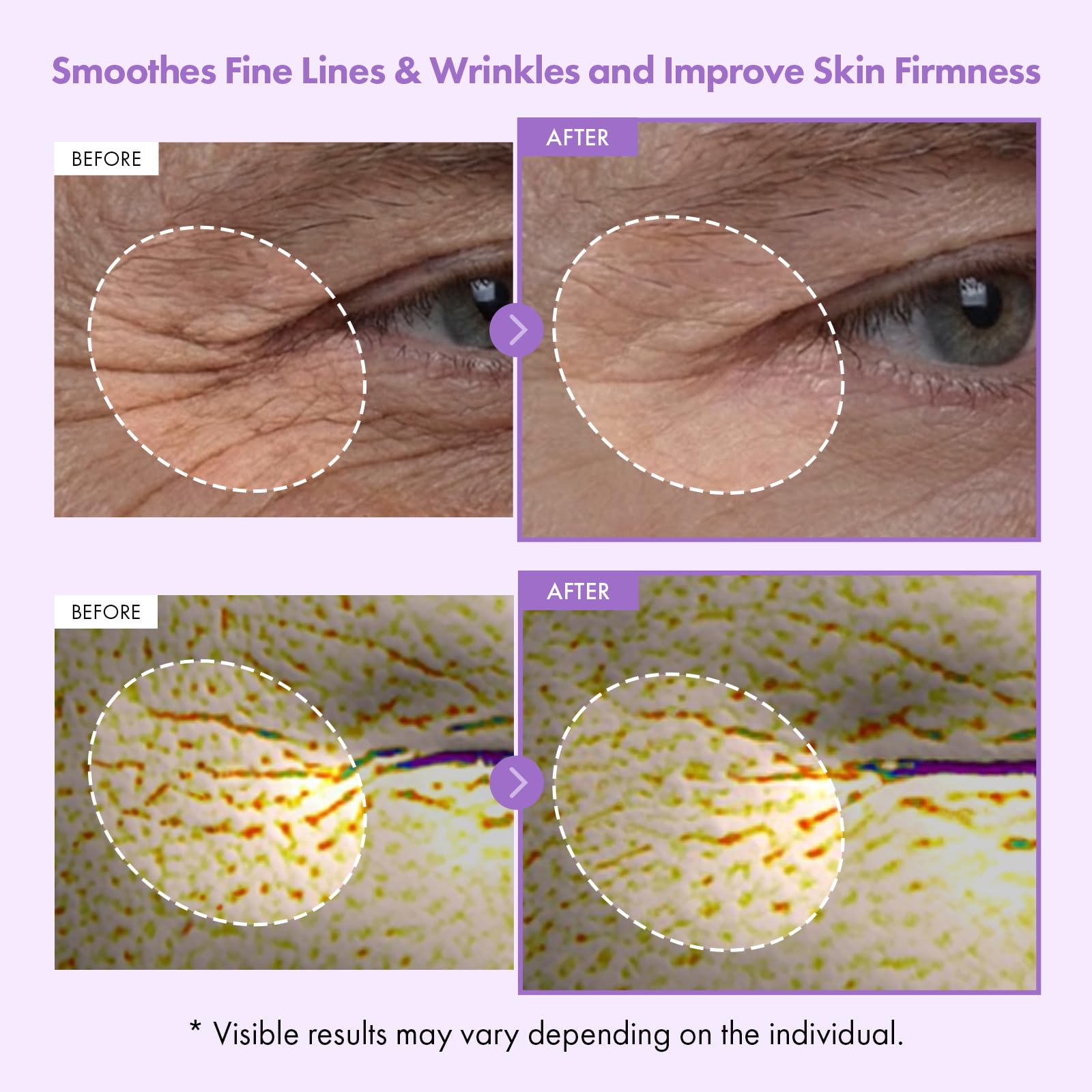 TOSOWOONG microcapsule close-up revealing burst capsules for fresh active delivery