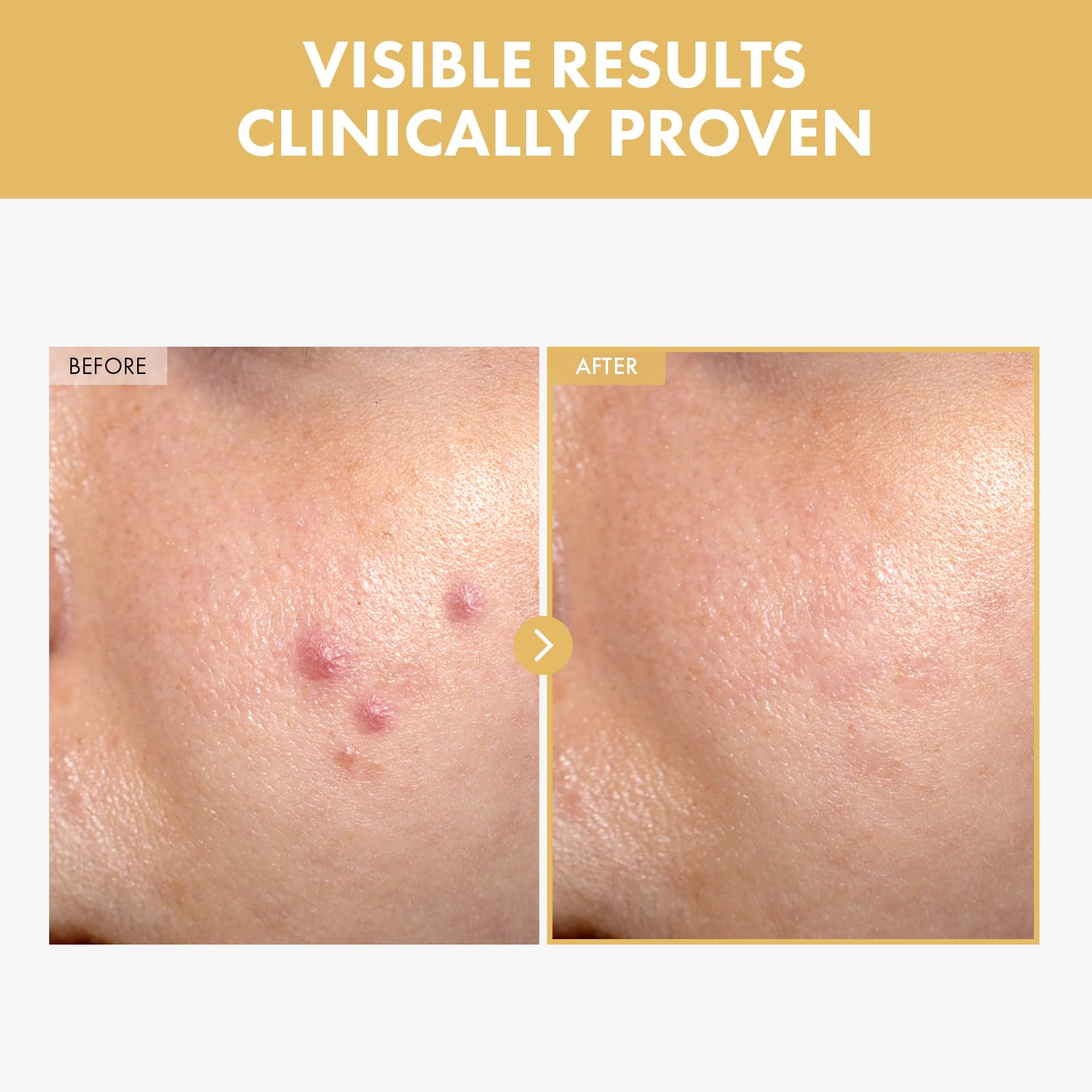 TOSOWOONG gel-serum texture close-up demonstrating fast absorption
