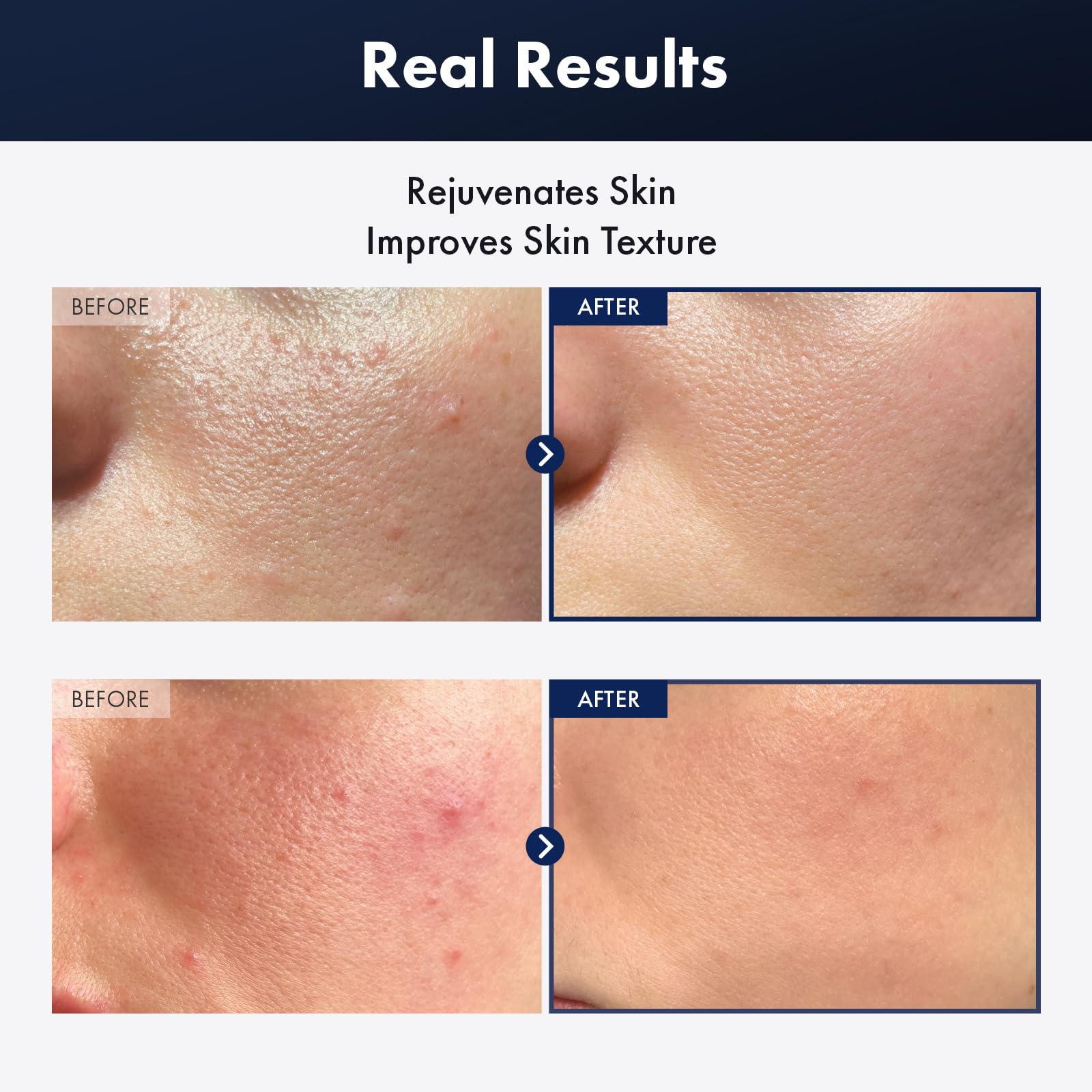 TOSOWOONG essence texture drop highlighting lightweight, fast-absorbing hydration