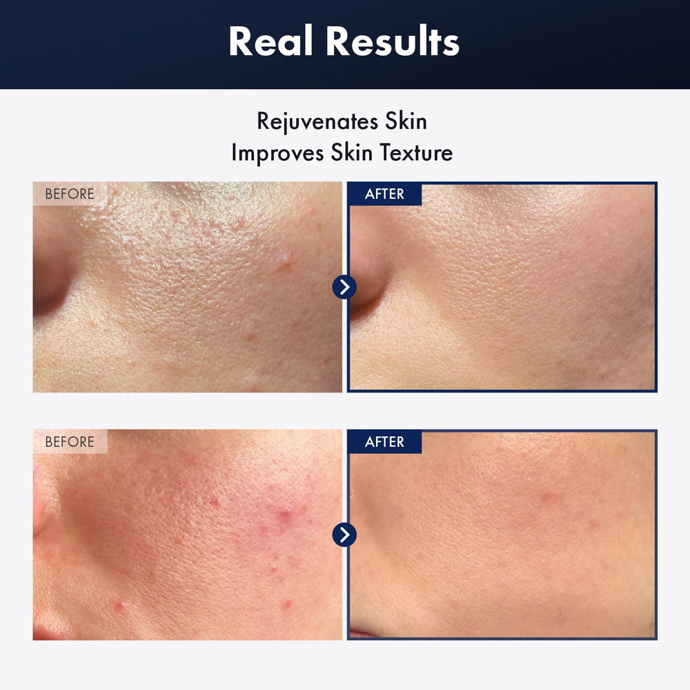 TOSOWOONG essence texture drop highlighting lightweight, fast-absorbing hydration