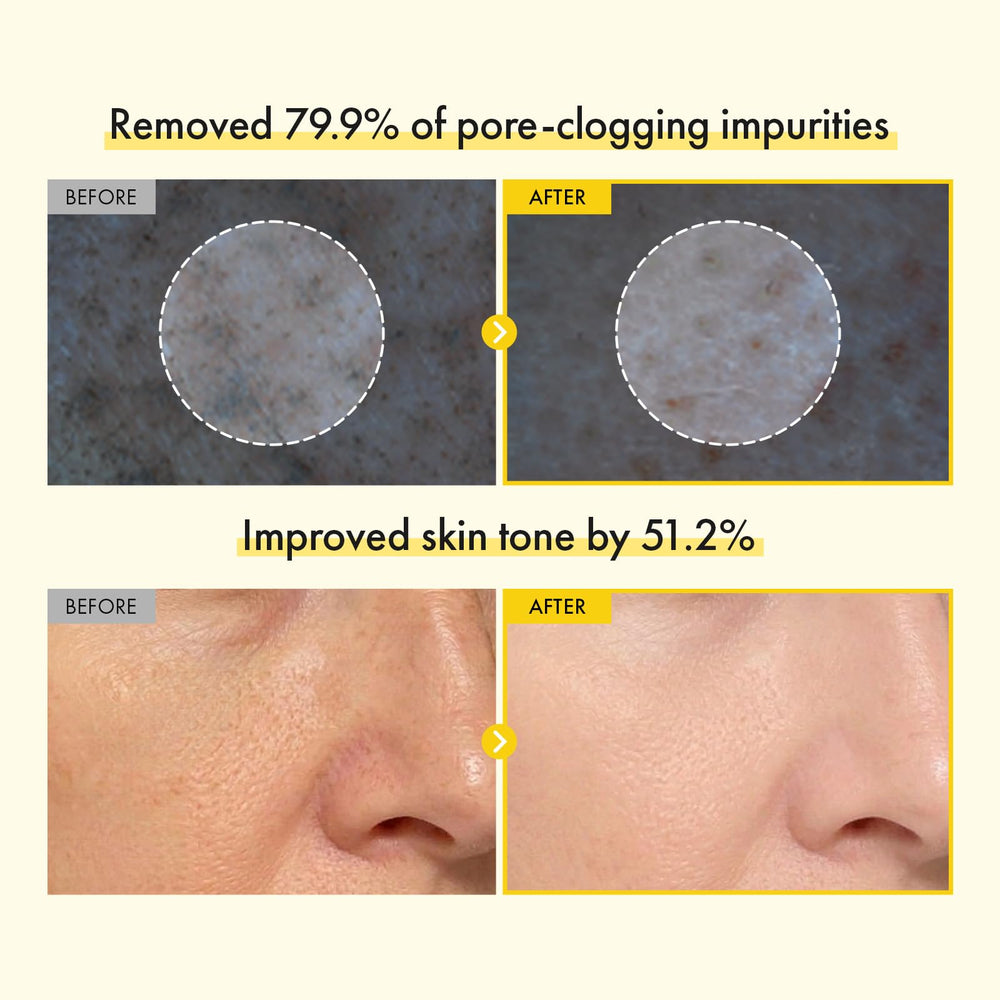 TOSOWOONG capsule detail close-up showing targeted pore-clearing action