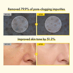 TOSOWOONG capsule detail close-up showing targeted pore-clearing action
