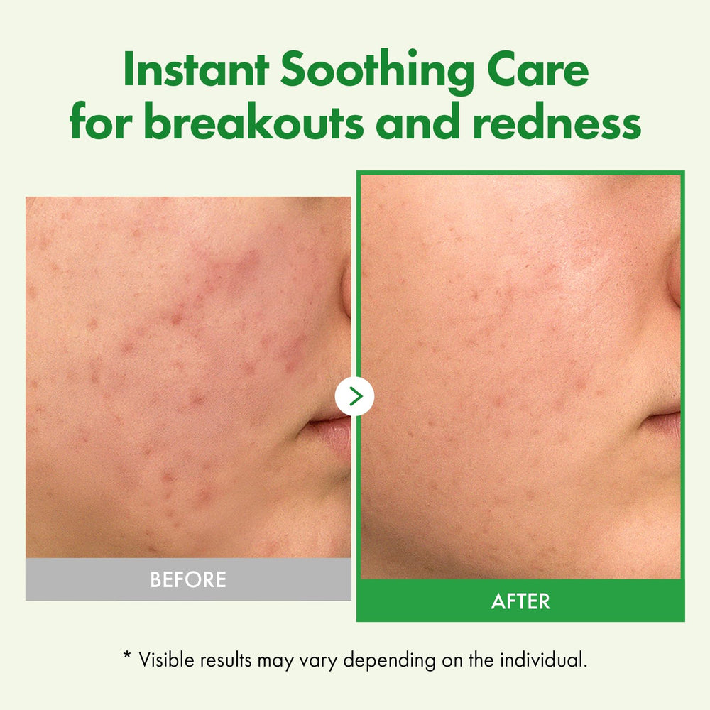 Tosowoong Centella Cream texture closeup reveals rich, hydrating consistency