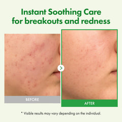 Tosowoong Centella Cream texture closeup reveals rich, hydrating consistency