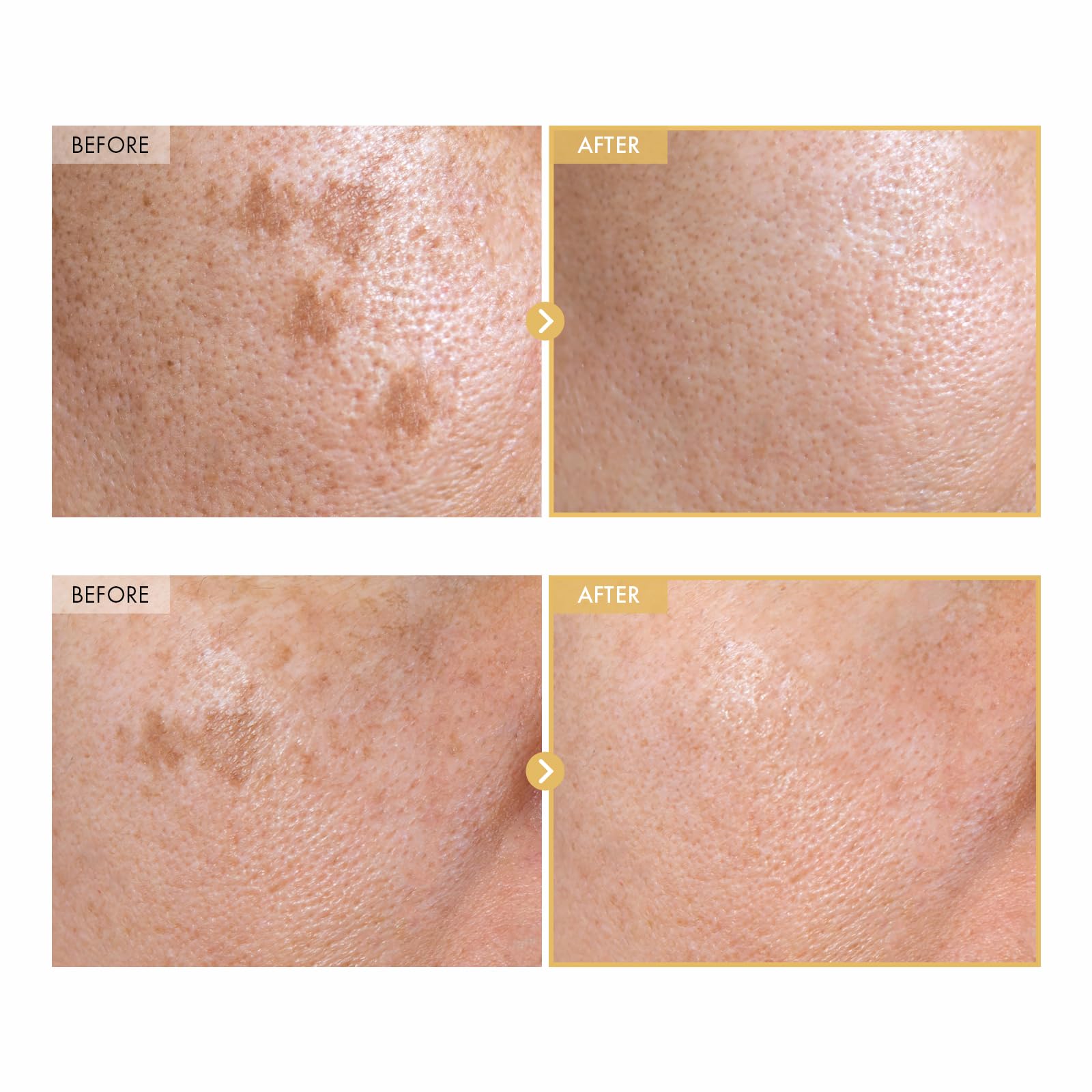 TOSOWOONG ginseng root ingredient image highlighting antioxidant boost