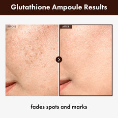 TOSOWOONG Glutathione Serum label highlights purity and ingredients