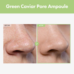 TOSOWOONG close-up dropper delivering precise serum dose for targeted pore care benefit