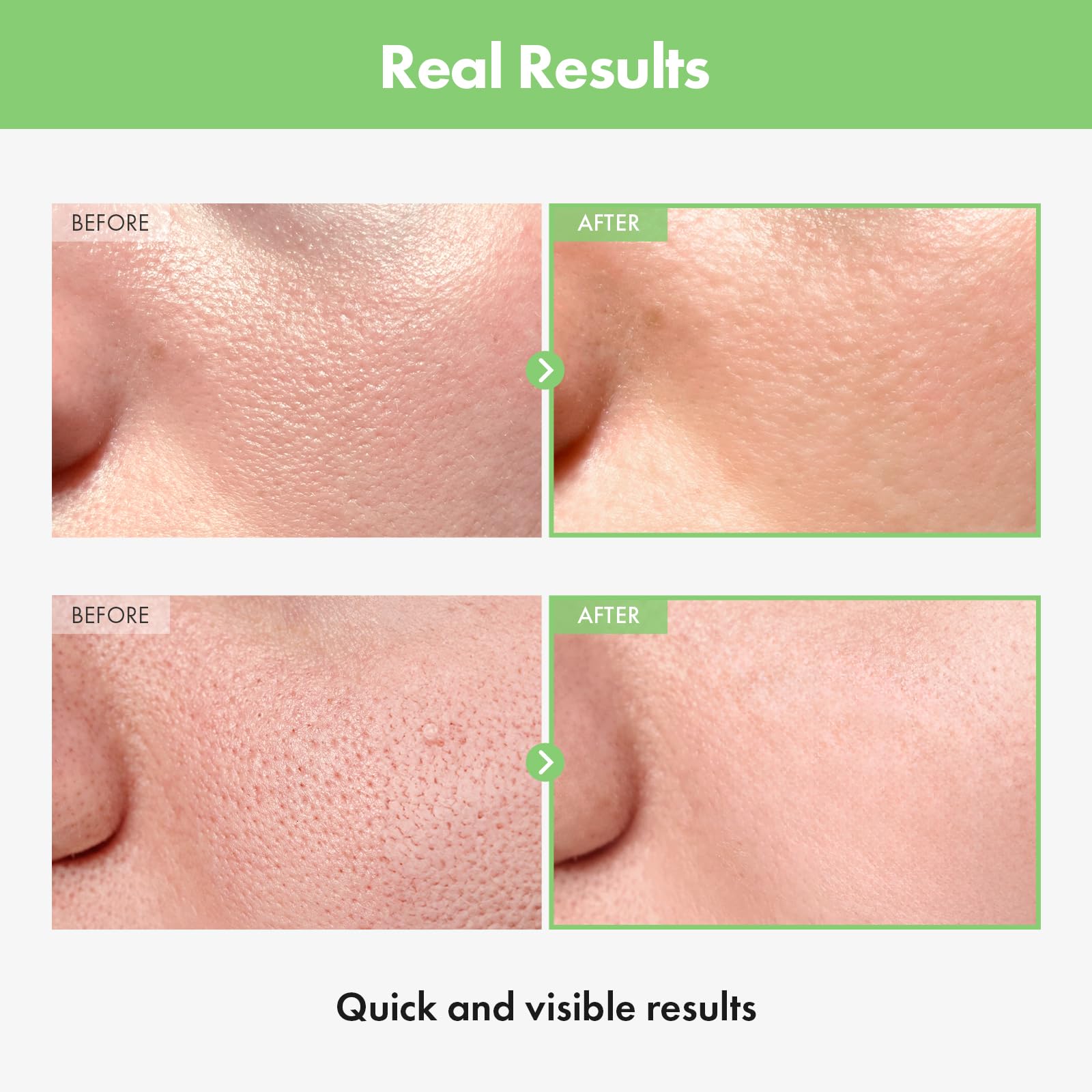 TOSOWOONG label close-up highlighting patented green tomato extract benefit