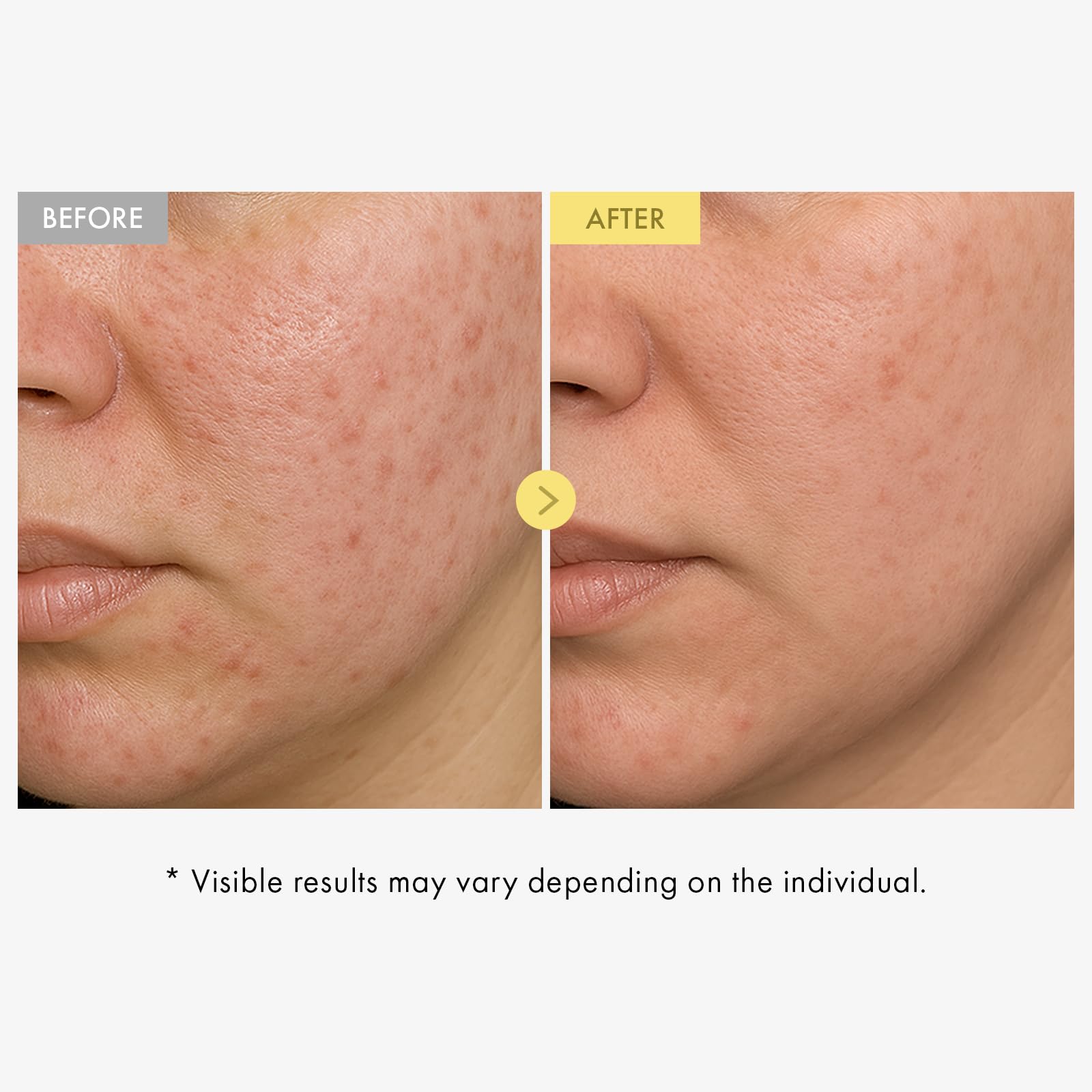 TOSOWOONG serum texture spread on hand showing lightweight absorption benefit