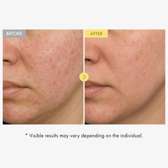 TOSOWOONG serum texture spread on hand showing lightweight absorption benefit