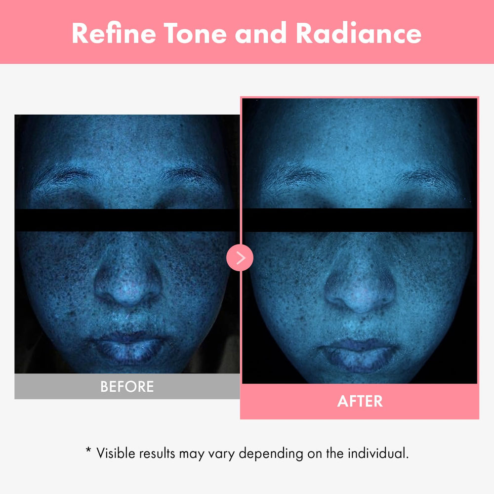 TOSOWOONG Salmon DNA ampoule emphasising skin renewal support