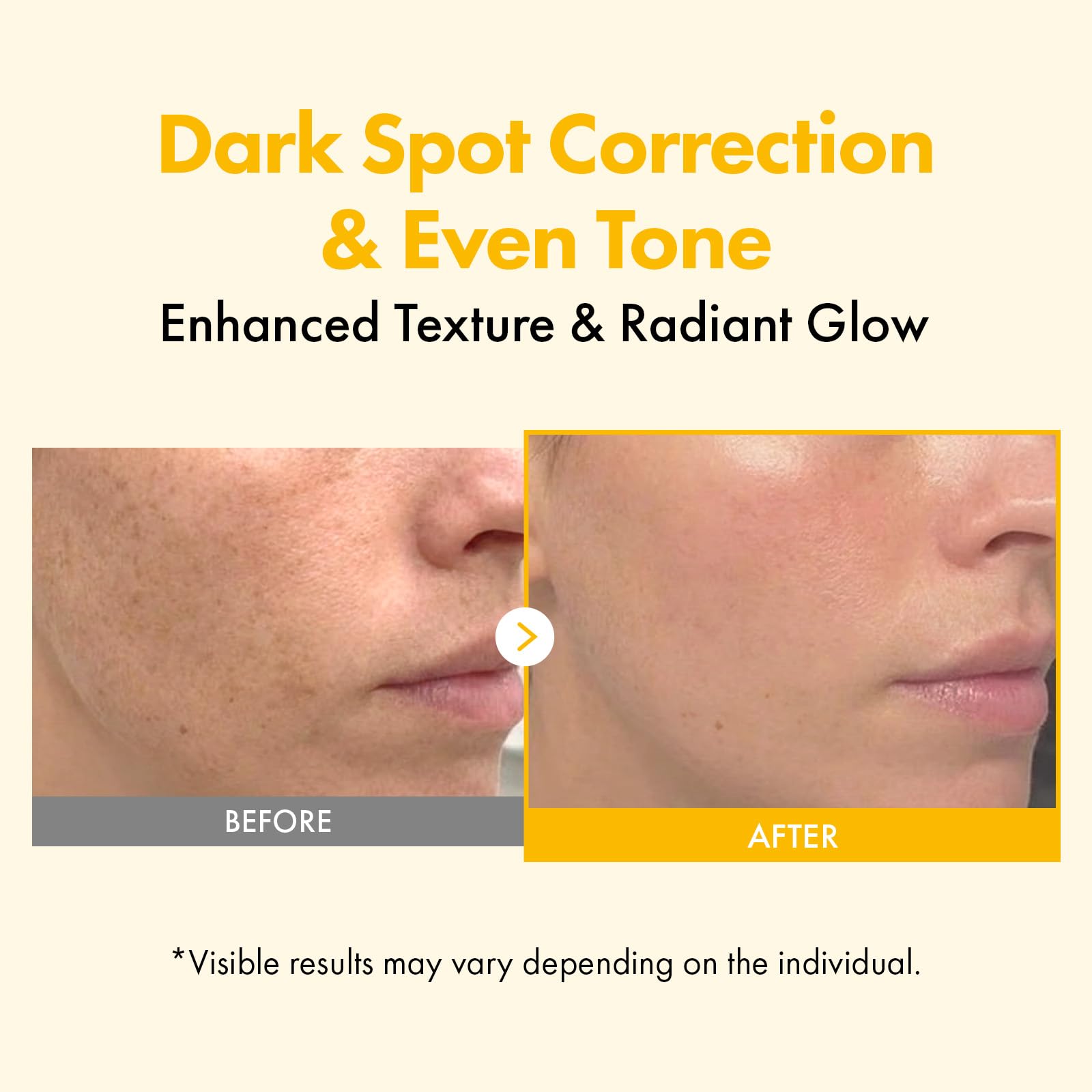 TOSOWOONG open jar close-up showing gel texture for even application benefit