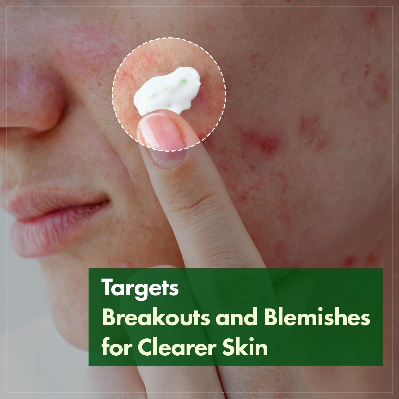 TOSOWOONG Madagascar Centella Cream packaging emphasizes premium, rapid soothing formula